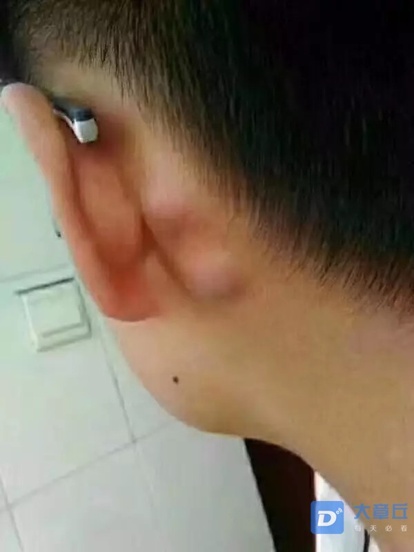 耳朵后面乳突骨图片
